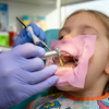 Gold Diamond Burs for Pediatric Dentistry: The Complete Clinical Reference