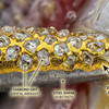 How Gold Plating Protects Diamond Grit on Dental Burs