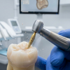 Anti-Vibration Properties of Gold Diamond Dental Burs: Benefits for Precision Dentistry